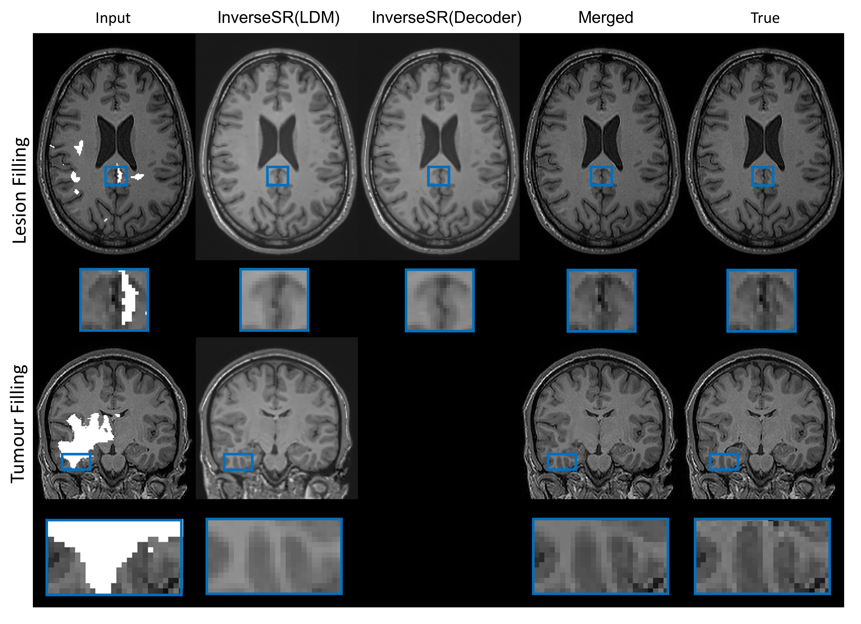 InverseSR: 3D Brain MRI Super-Resolution Using a Latent