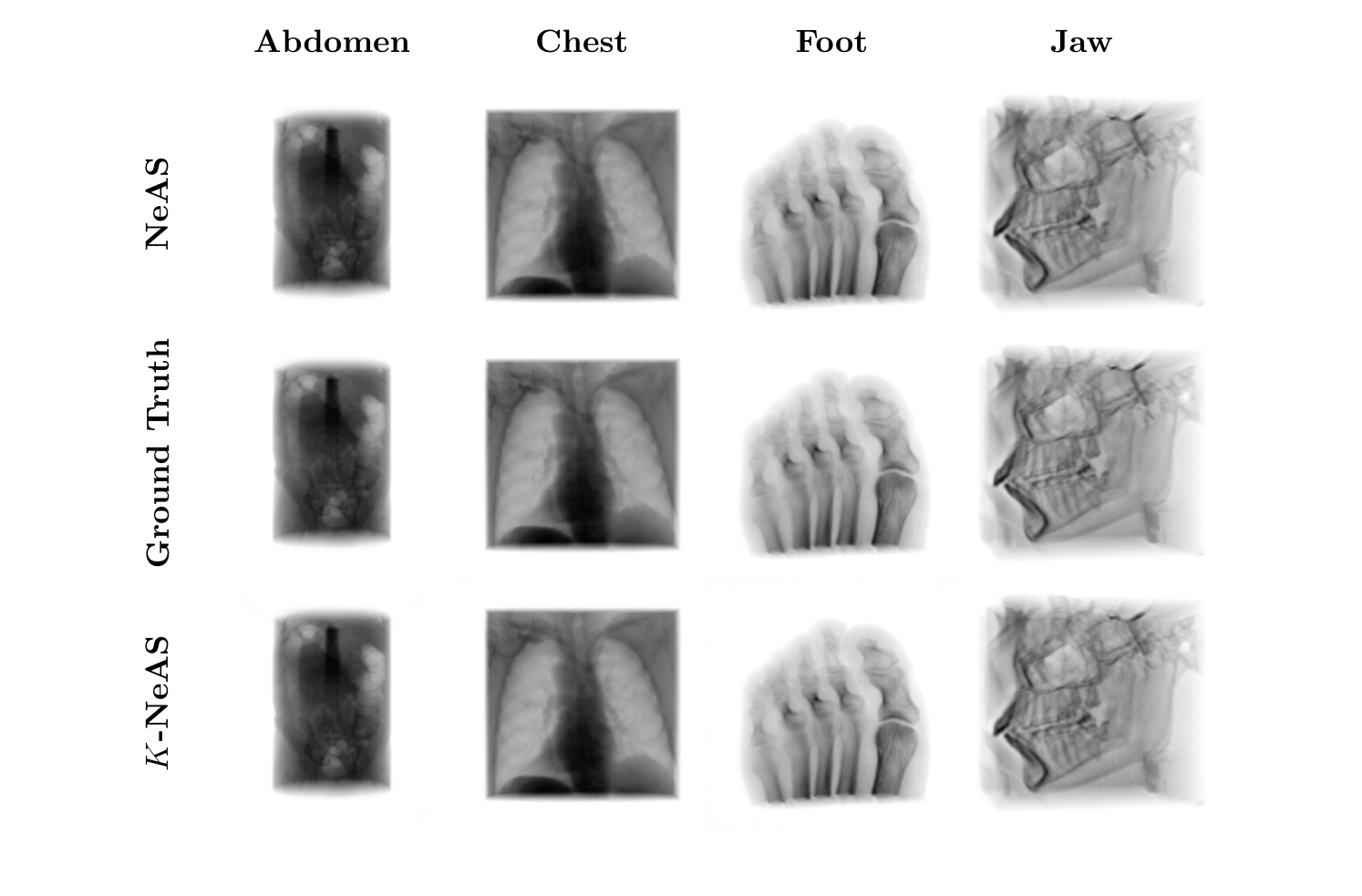 Extract from the paper: Figure 4: CT reconstruction comparisons