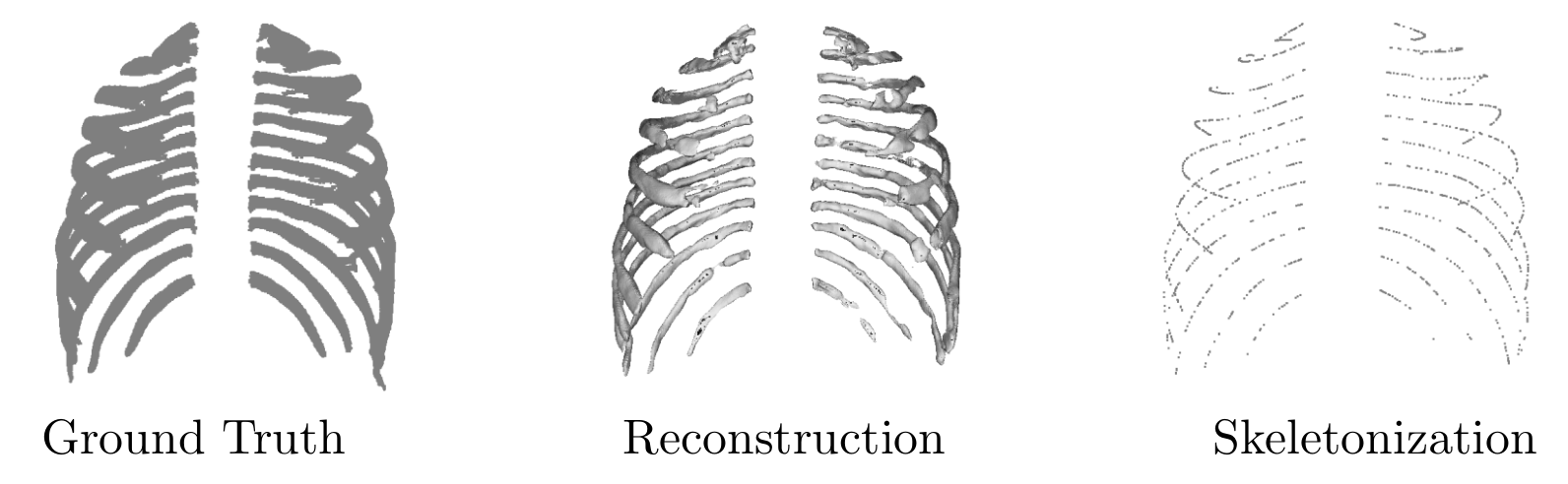 Extract from the paper: Figure 3: Ground truth, surface reconstruction, and ribcage skeletonization