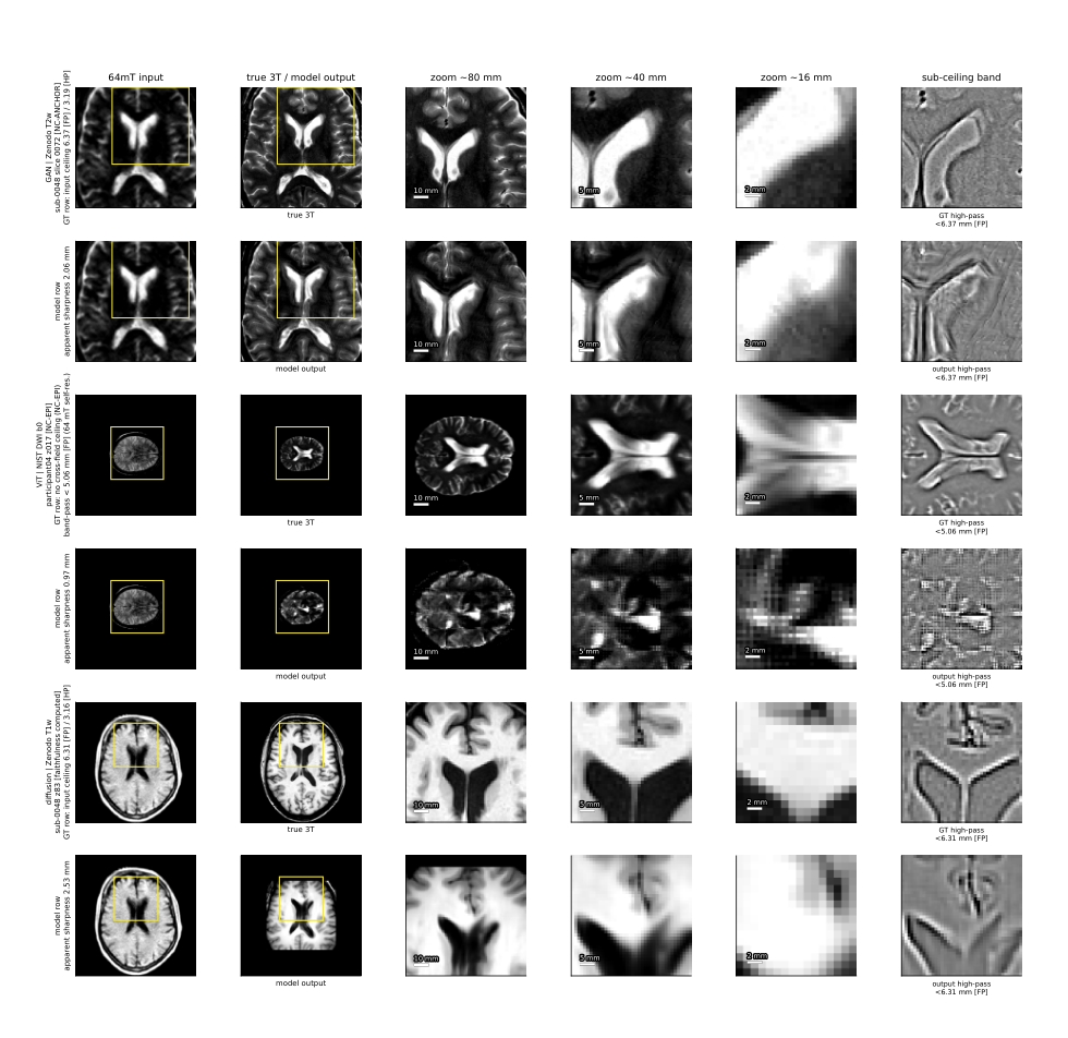 Extract from the paper: Figure 3: Anatomical detail and the measured information ceiling
